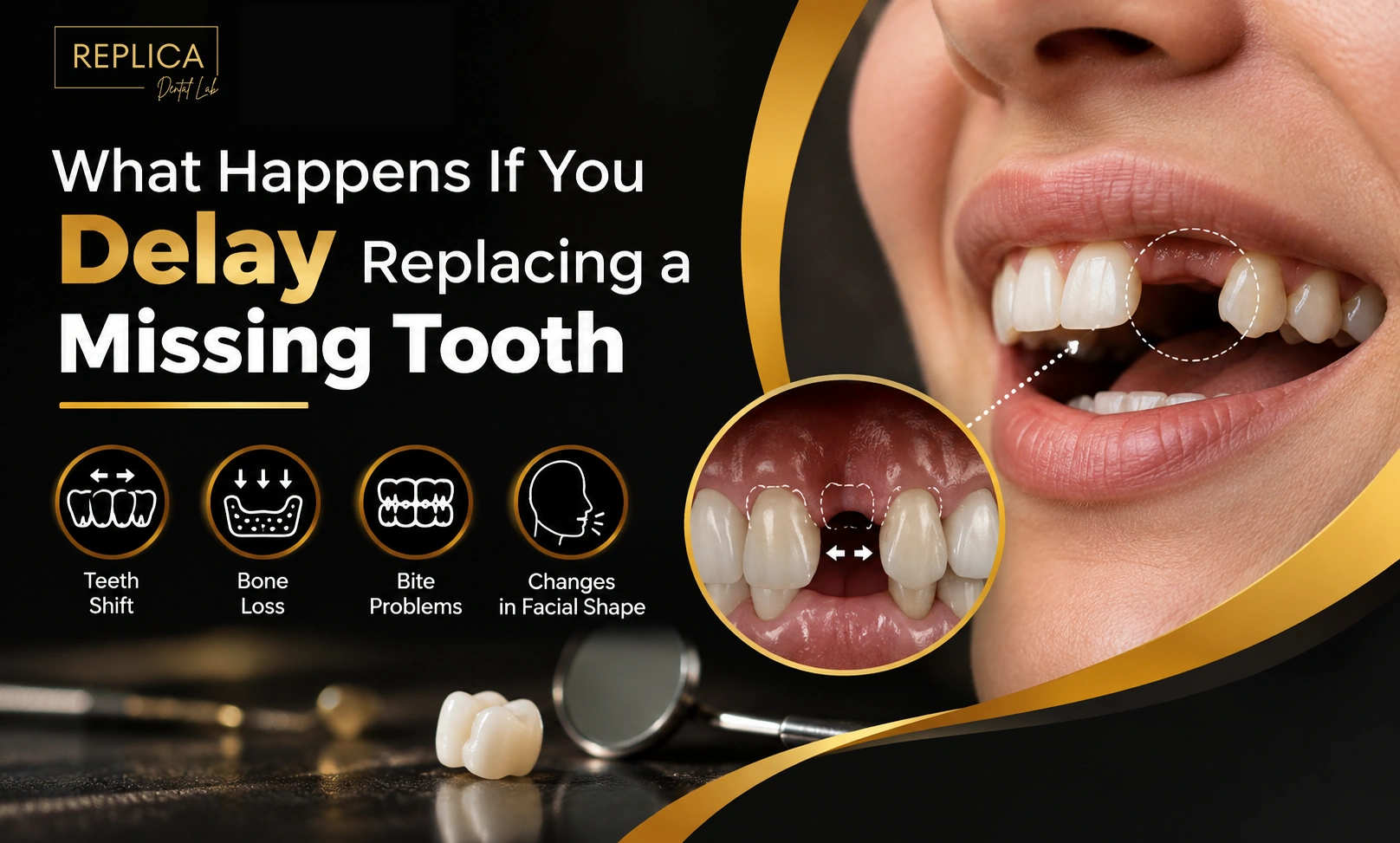 What Happens If You Delay Replacing a Missing Tooth